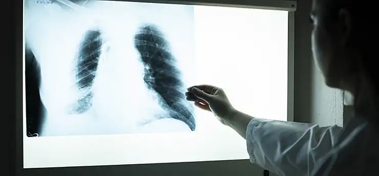 Sigaranın en ağır faturası: Koah riski 45 yaş sonrası hızla artıyor