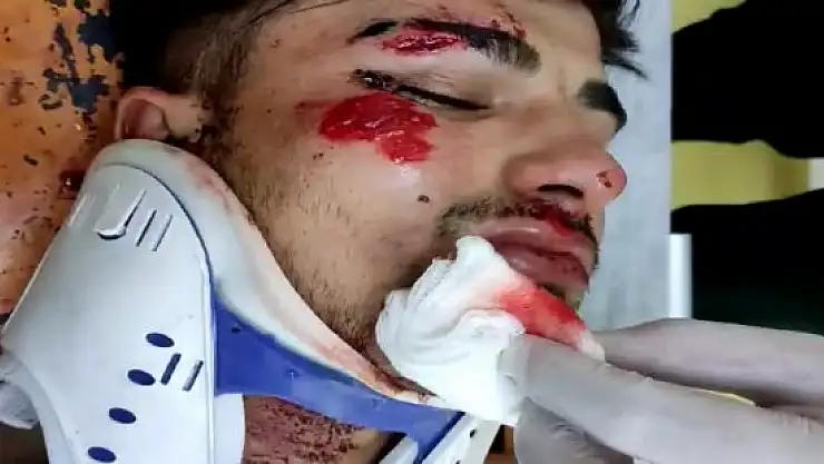 Patnos'ta ehliyetsiz motosiklet sürücüsü polis aracına çarptı