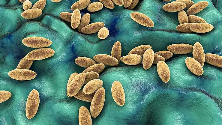 Peynir Hastalığı Nedir?