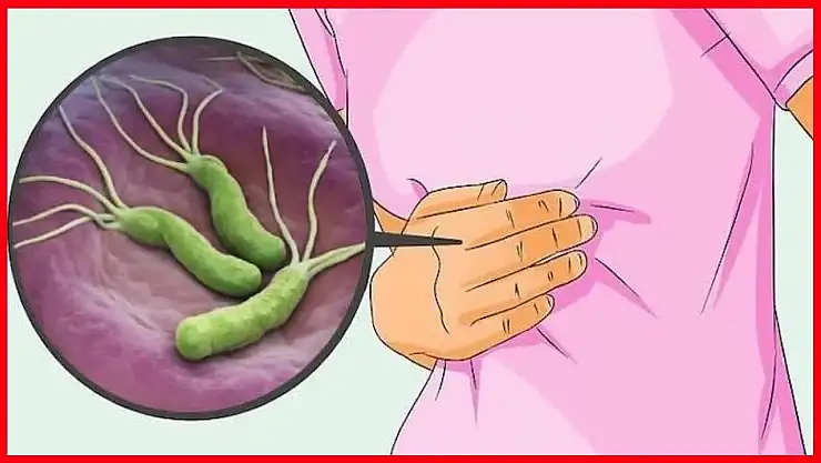 Helikobakteri Neden Olur?