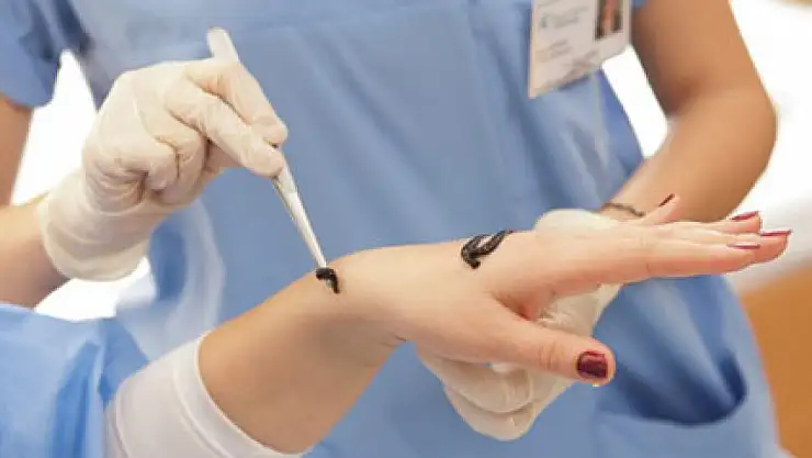 Sülük Nedir? Sülük Tedavisi Nasıl Yapılır? Faydaları Nelerdir? Sizler için araştırdık…