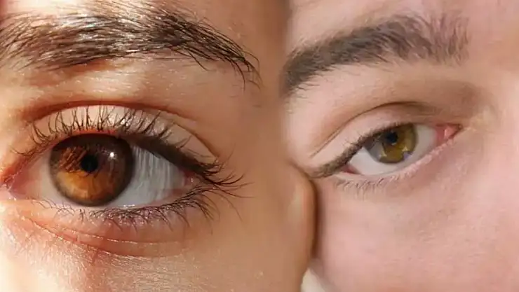 Sağ göz seğirmesi neden olur?