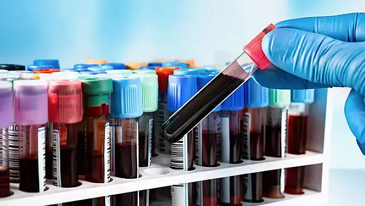 Türkiye'de gizli pandemi! Dünyada azalırken Türkiye'de yükseliyor