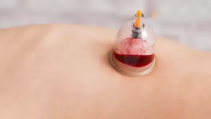 Hacamattan Sonra Neden Hayvansal Gıda Yenmez?