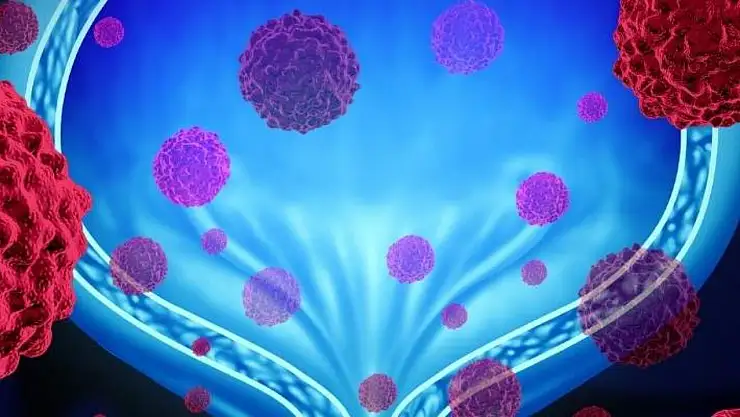 Yassı Epitel Yüksekliği Neden Olur?