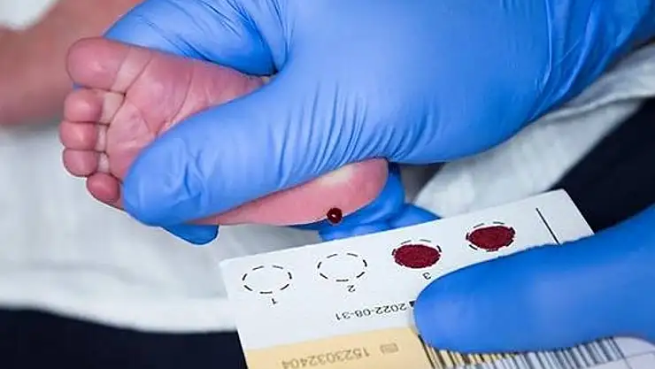 Topuk Kanı Neden Alınır?