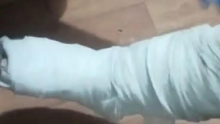 Alçılı ayaktan Eroin çıktı