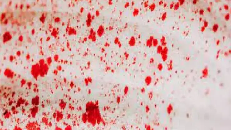 Rüyada ağızdan kan gelmesi, Rüyada ağzından kan geldiğini görmek ne anlama gelir?