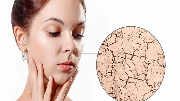 Kuru Ciltler İçin Günlük Cilt Bakımı Nasıl Olmalıdır?