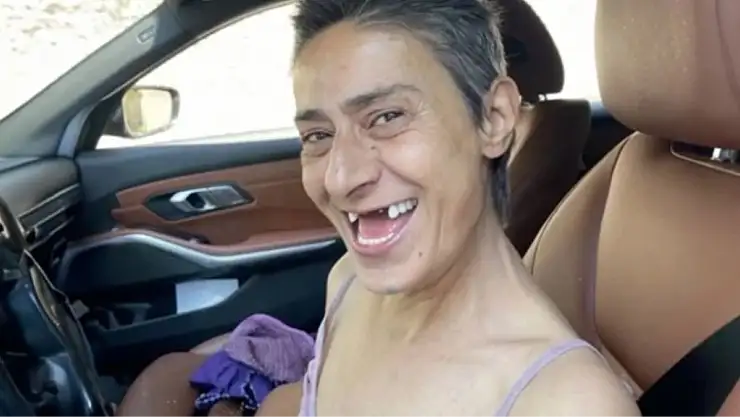 Yıldız Tilbe'nin dişleri neden yok? Yıldız Tilbe'in dişsiz pozu olay oldu!