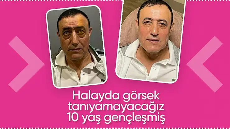 Mamudo Gurban Ne Yaptın Sen Öyle?