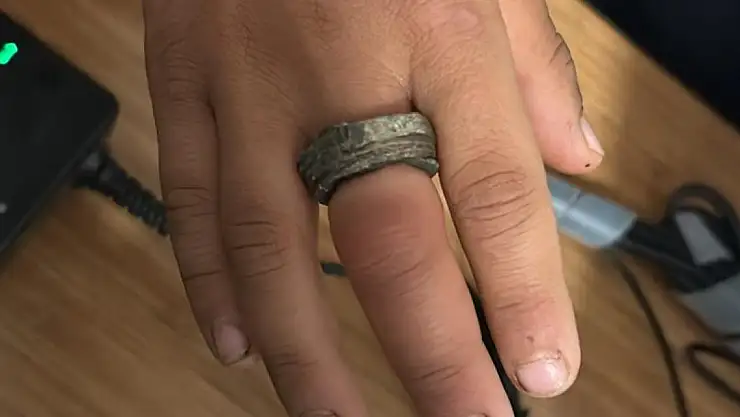 Parmağına taktığı demir halkayı çıkaramadı