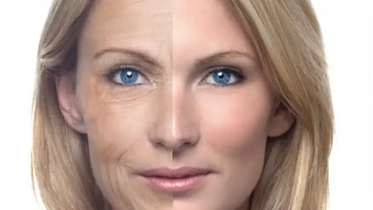 Güneşe maruz kalmak kırışıklığa neden oluyor