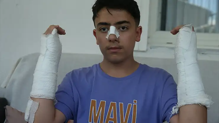 Kars'ta sahipsiz köpek 13 yaşındaki çocuğa saldırdı