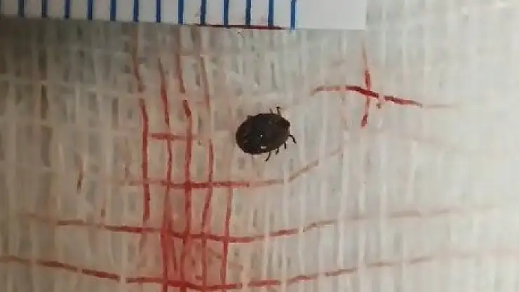 Bitlis'te gözü ağrıyan kız çocuğunun gözünden canlı kene çıktı