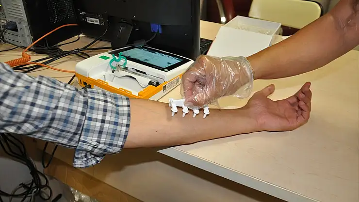 Kars Harakani Devlet Hastanesi'nde alerji testi uygulaması başladı