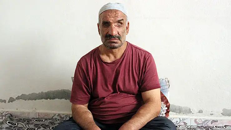 Geçirdiği kaza hayatını karanlığa çevirdi