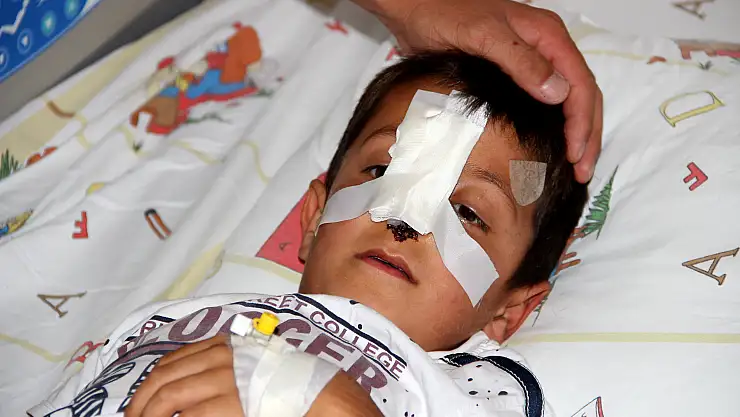 Başıboş dolaşan sokak köpekleri, minik Bünyamin'in burnunu kopardı