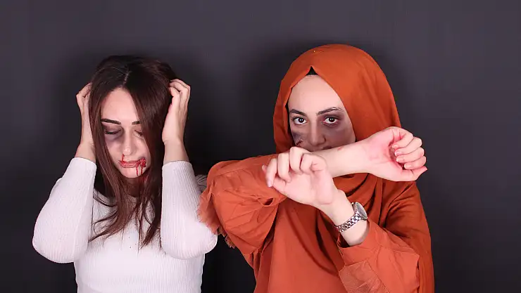 Kadına Şiddete Dayak Makyajıyla Dikkat Çekiyorlar