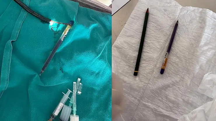Ağrı'da ilk kez görülen vaka: Midesinden iki kalem çıkarıldı!