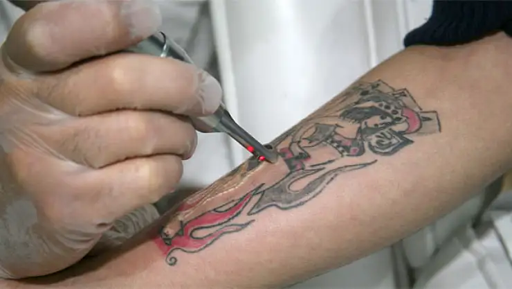 Dövme yaptırmak kanser riskini artırabilir