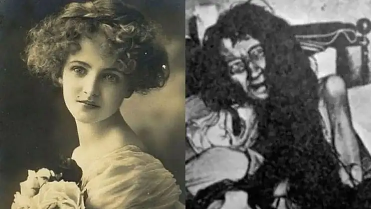 Erkekler Kendisine Aşık Diye Annesi Tarafından 25 Yıl Boyunca Bir Odaya Hapsedilen Blanche Monnier'in Akılalmaz Hikayesi