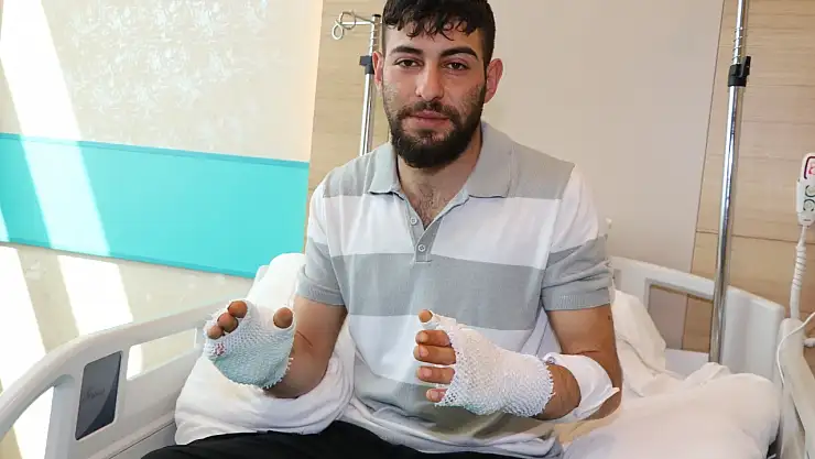 Erzurum'da otomobil hararet yapınca su haznesinden taşan sıcak suyla yanık yaşayan teknisyen hastanede tedavi ediliyor.