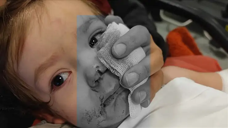 Etimesgut'ta pitbull saldırısı: Köpek sahibi tutuklandı, çocuklar hastaneye kaldırıldı