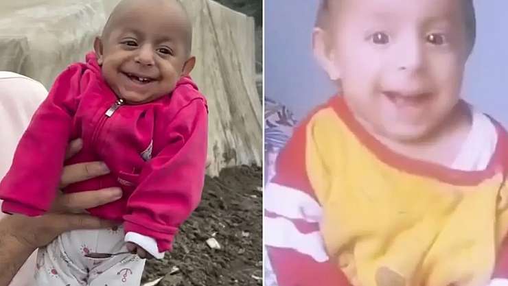 'Gülen Bebek' olarak tanınan Ökkeş bebek kimdir, kaç yaşındaydı, hastalığı neydi, neden öldü?