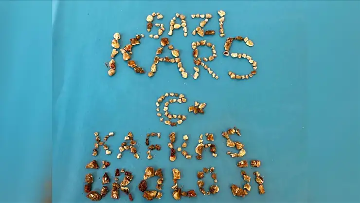 İki Böbrekten 300'ün Üzerinde Taşın Çıkarıldığı Ameliyat Başarıyla Sonuçlandı