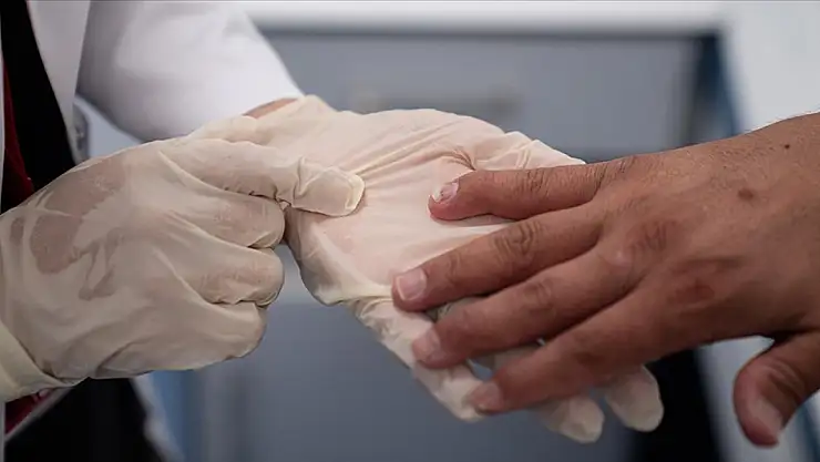 Sedef romatizmasında erken tanı hayat kurtarıyor