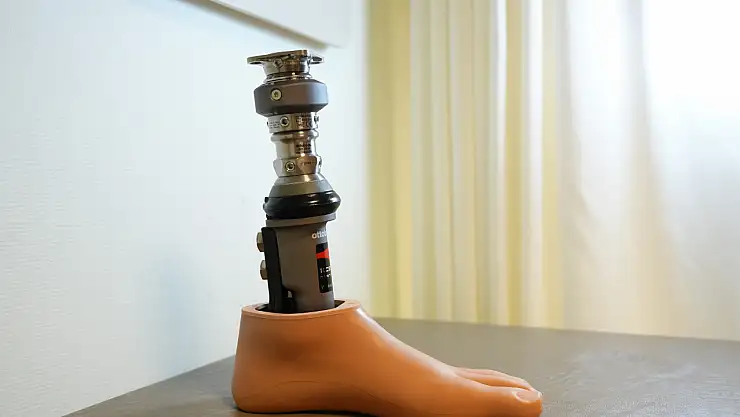 Türkiye'de ilk kez uygulandı: Genç amputelere özel çözüm