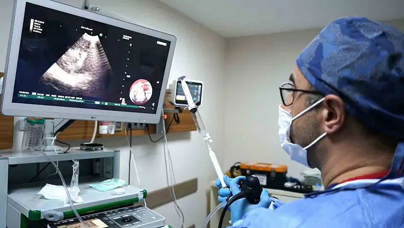 Cerrahiye ihtiyaç bırakmayan tanı yöntemi: EBUS