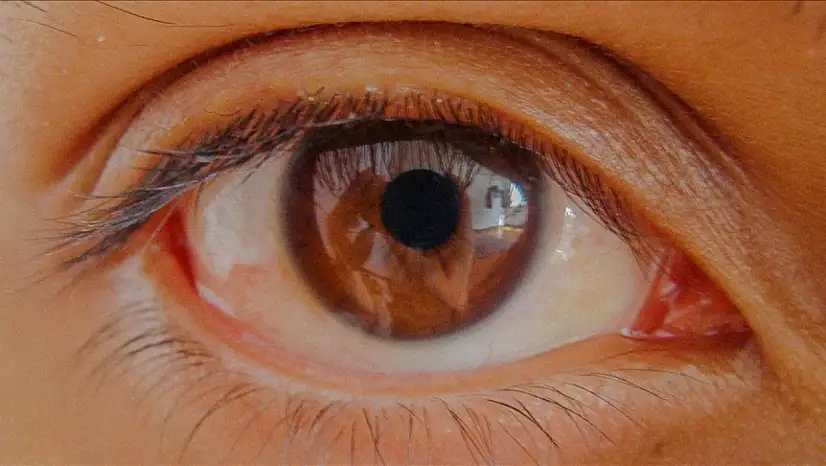 Glokomda erken teşhis kalıcı görme kaybını engelliyor