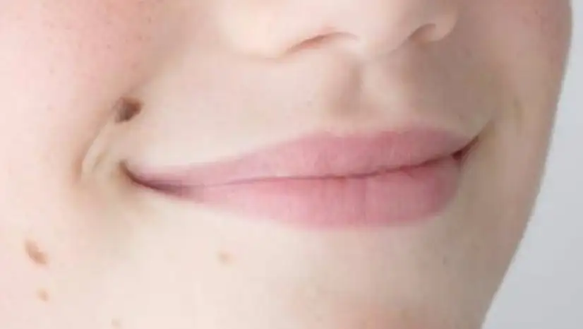 Lazerle ben aldırmak sandığınız kadar masum değil