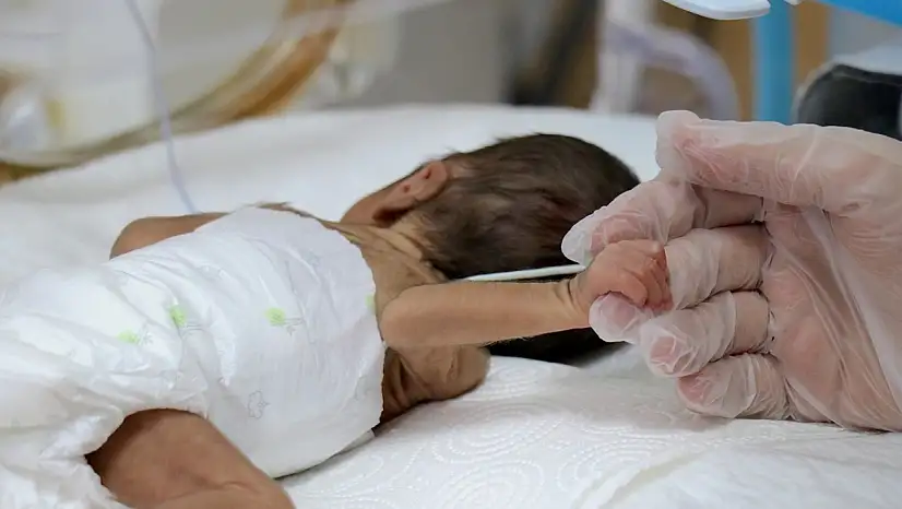 Parmak bebekler hayata burada tutundu