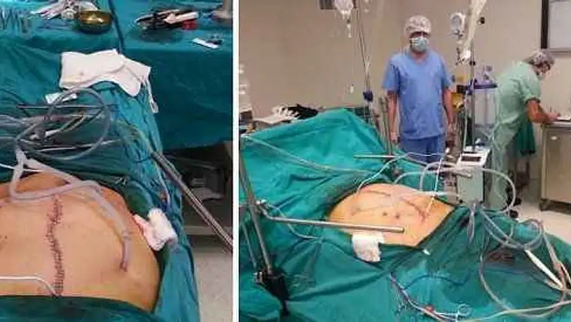 Sıcak kemoterapi nedir, kimlere, kaçıncı evrede yapılır? Sıcak kemoterapi ne kadar sürer?